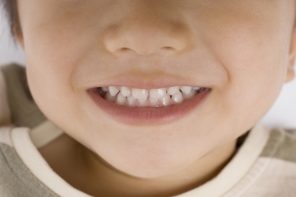 小児期の予防歯科
